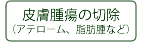 皮膚腫瘍の切除　（アテローム、脂肪腫　など）