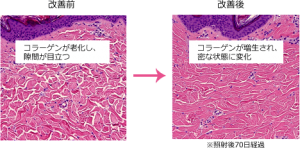 collagen